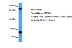 ATPBD4 Rabbit anti-Human, Polyclonal, Novus Biologicals 0.1 mL | Buy Online | Novus Biologicals | Fisher Scientific